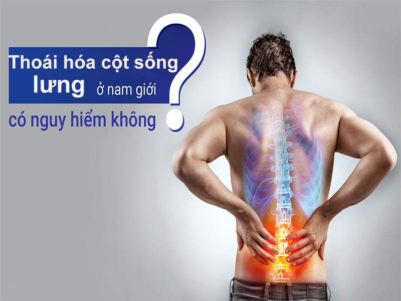Ở nam giới bệnh thoái hóa cột sống lưng là nguyên nhân chính dẫn đến các cơn đau lưng